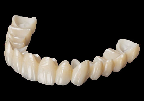 Phong cách thẩm mỹ cao Full Contour Zirconia Crown