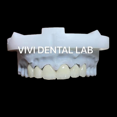 Lớp răng Zirconia vương miện và cầu xuyên suốt 3D PRO
