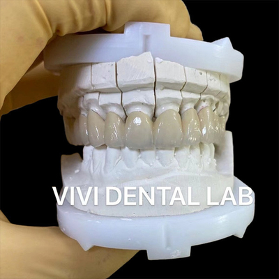 Vương miện phòng thí nghiệm nha khoa chính xác sứ thẩm mỹ Vương miện răng Zirconia