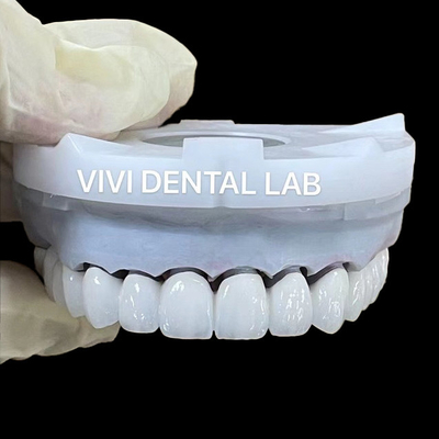 Super trắng Zirconia Vương miện phòng thí nghiệm nha khoa 3D PRO PFZ Noritake sứ