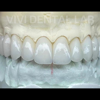 Phòng thí nghiệm nha khoa Zirconia và cây cầu làm việc chuyên nghiệp ổn định