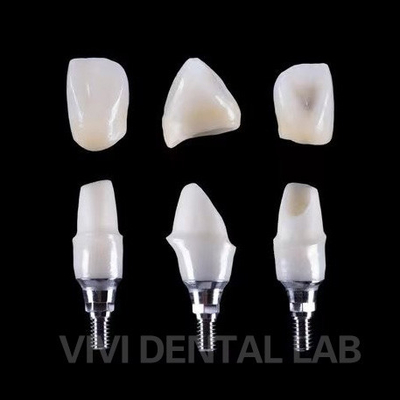 Cấy ghép răng Tibase Zirconia Abutment Titanium Độ chính xác tùy chỉnh