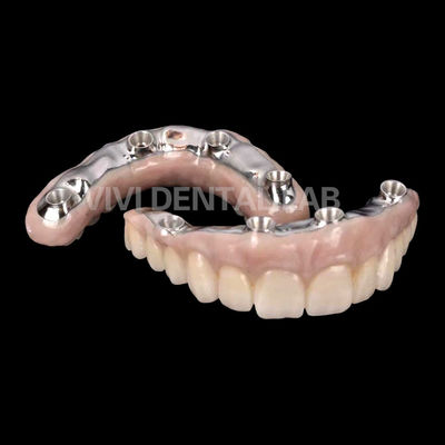 Vương miện cấy ghép răng Zirconia tương thích sinh học với thanh titanium