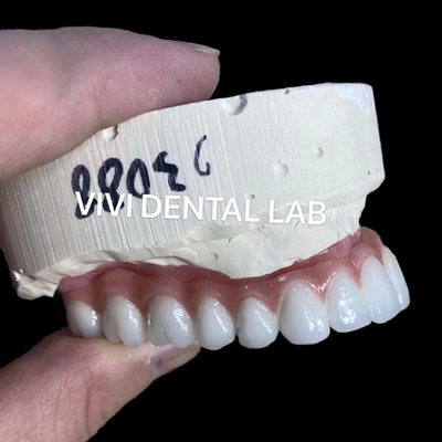 Nhìn tự nhiên Vòng vít thẩm mỹ được giữ lại Circonia Implant Crown Long Lasting