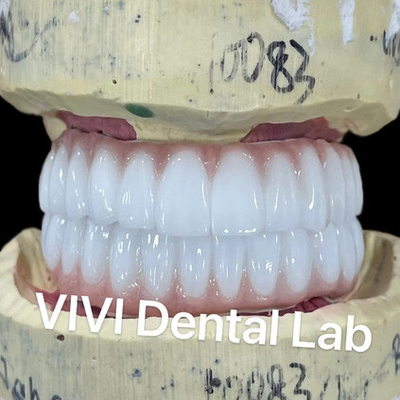 Ni Be Free Zirconia Dental Implant Bridge On Bar Esthetics cao