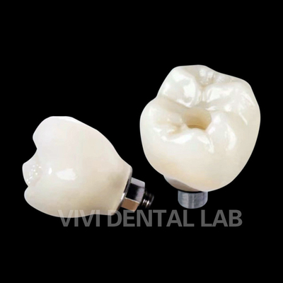 Vít giữ cấy ghép răng vương miện PFZ Porcelain lớp Zirconia