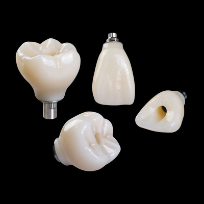 Mẫu cấy ghép răng chuyên nghiệp Zirconia Crown Titanium CAD CAM
