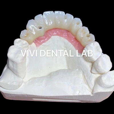 PMMA độ chính xác Full Zirconia Bridge Over Multi Unit Abutments