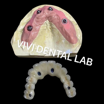 Đọc tất cả trên bốn cây cầu Zirconia Ivoclar nha khoa chính xác cao