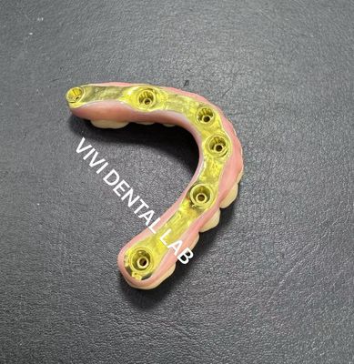 Cây cầu kim loại Zirconia đầy đủ với thanh Titanium hỗ trợ Trung Quốc Phòng thí nghiệm nha khoa