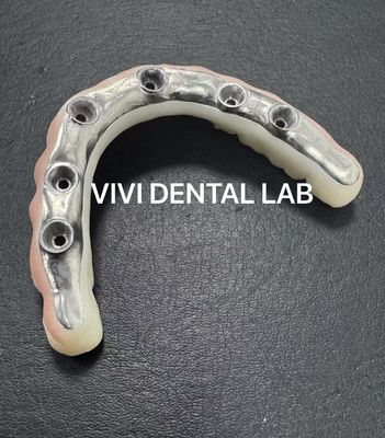 Phong cầu kim loại Zirconia đầy thẩm mỹ với thanh Titanium được vặn giữ từ phòng thí nghiệm nha khoa Trung Quốc