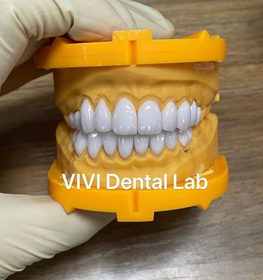 Ivoclar Emax Laminate Veneers Trung Quốc Phòng thí nghiệm nha khoa