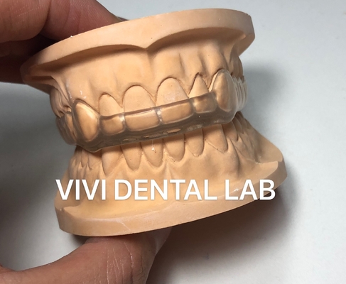 Night Dental Mouth Guard Occlusal Splint Ekodent Phong cách tốt thẩm mỹ cao
