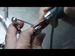 PFM Crown và Bridges