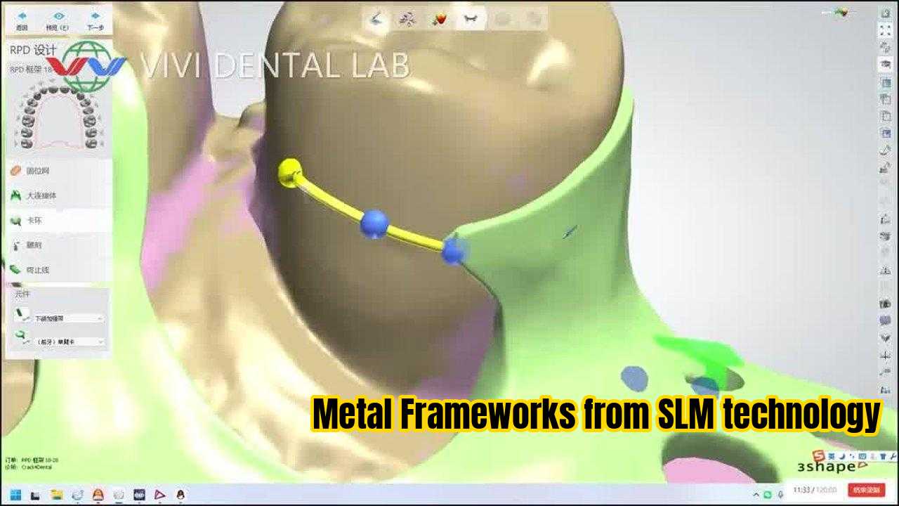 Trung Quốc VIVI DENTAI LABORATORY Chứng chỉ